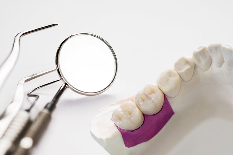 ما هو الفرق بين طب الأسنان الترميمي وطب الأسنان التجميلي